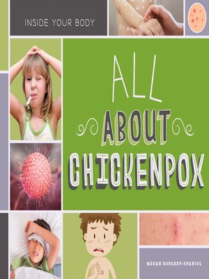 cover image of All About Chickenpox
